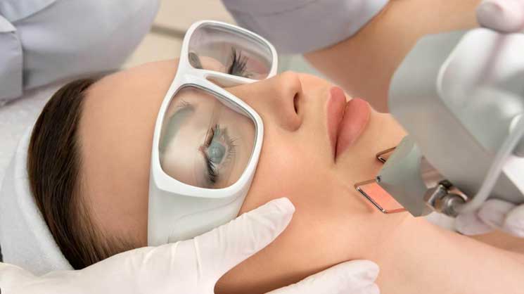 Fraksiyonel Lazer ile Kırışıklık Tedavisi